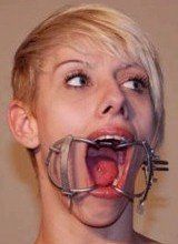Bondage dentist uses mouth straps