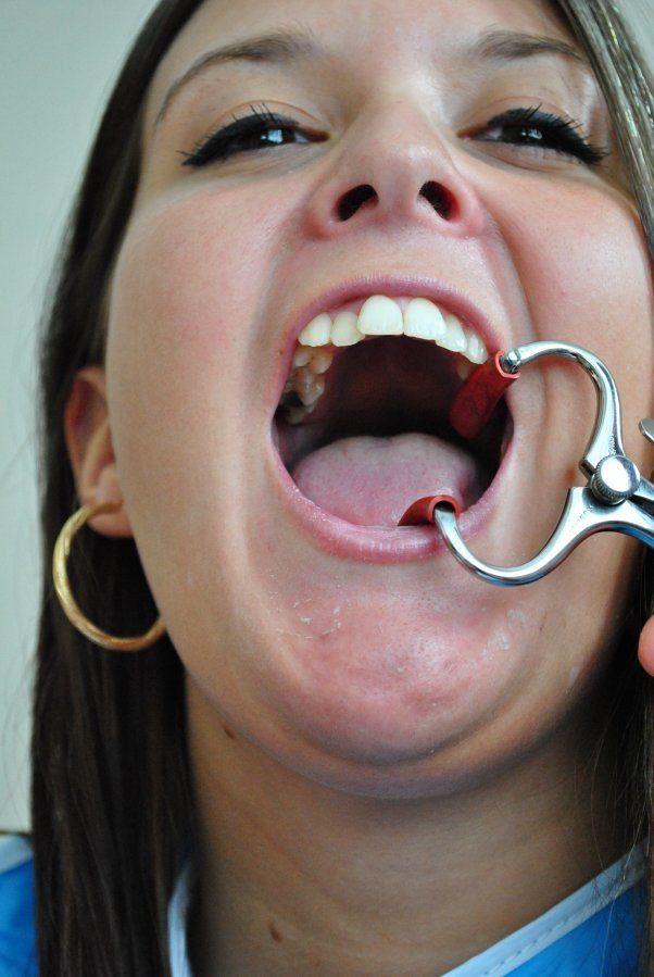 best of Dentist mouth straps uses bondage