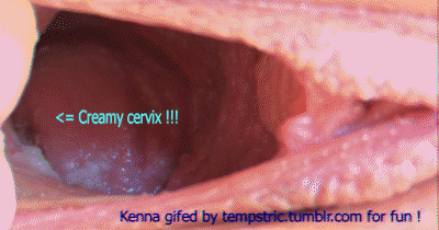 Cervix view pussy gaping
