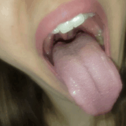 Snowdrop reccomend mouth tongue uvula teeth show short