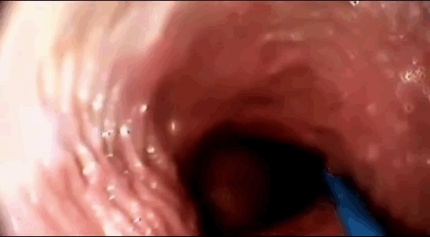 The T. reccomend girl orgasm filmed from inside vagina