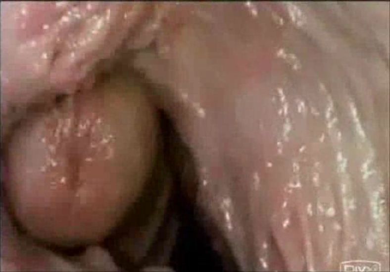 Finch reccomend girl orgasm filmed from inside vagina