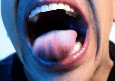 Lobster reccomend mouth tongue uvula teeth show short