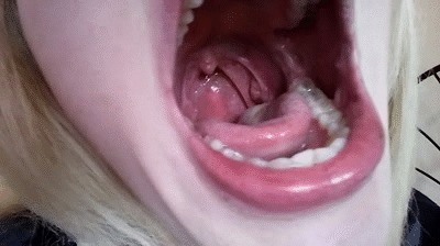 TD reccomend mouth tongue uvula teeth show short